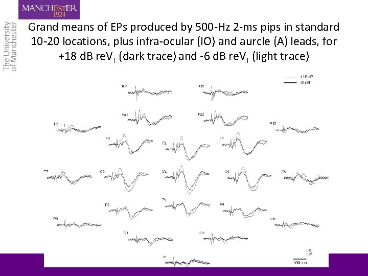 Grand means of EPs produced by 500 -Hz 2 -ms pips in standard 10