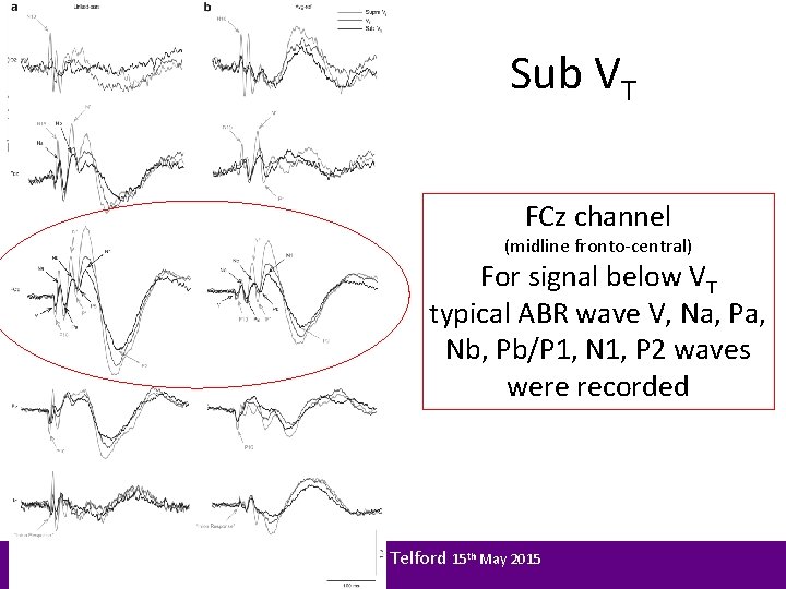 Sub VT FCz channel (midline fronto-central) For signal below VT typical ABR wave V,