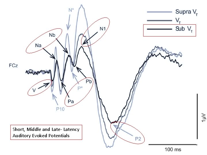 Short, Middle and Late- Latency Auditory Evoked Potentials BSHAA Congress - Telford 15 th