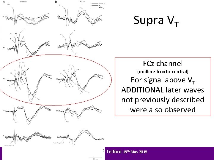 Supra VT FCz channel (midline fronto-central) For signal above VT ADDITIONAL later waves not