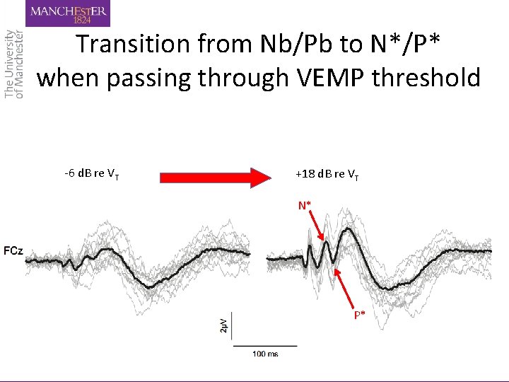 Transition from Nb/Pb to N*/P* when passing through VEMP threshold -6 d. B re