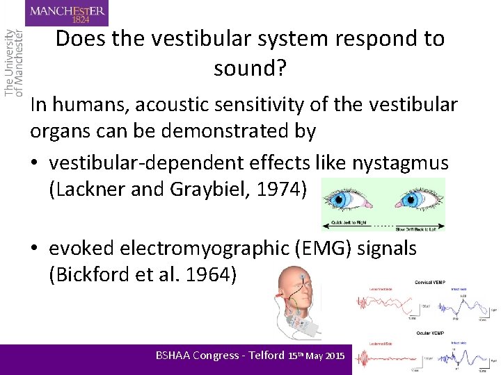 Does the vestibular system respond to sound? In humans, acoustic sensitivity of the vestibular