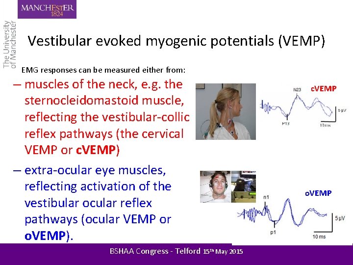 Vestibular evoked myogenic potentials (VEMP) EMG responses can be measured either from: – muscles