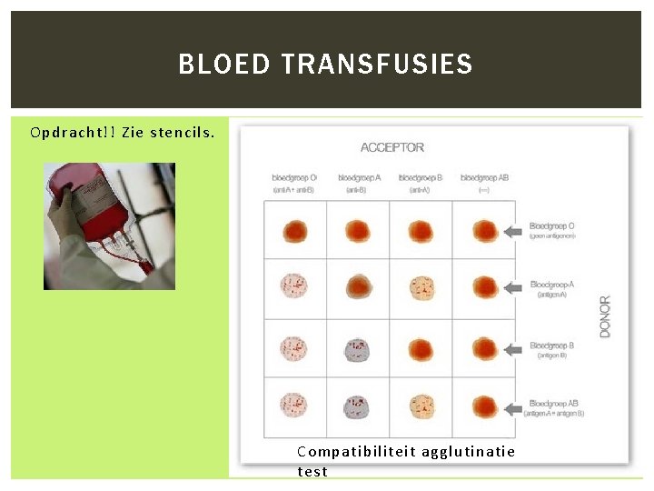 BLOED TRANSFUSIES Opdracht!! Zie stencils. Compatibiliteit agglutinatie test 