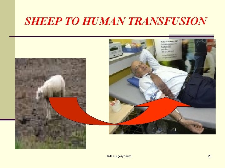 SHEEP TO HUMAN TRANSFUSION 428 surgery team 20 