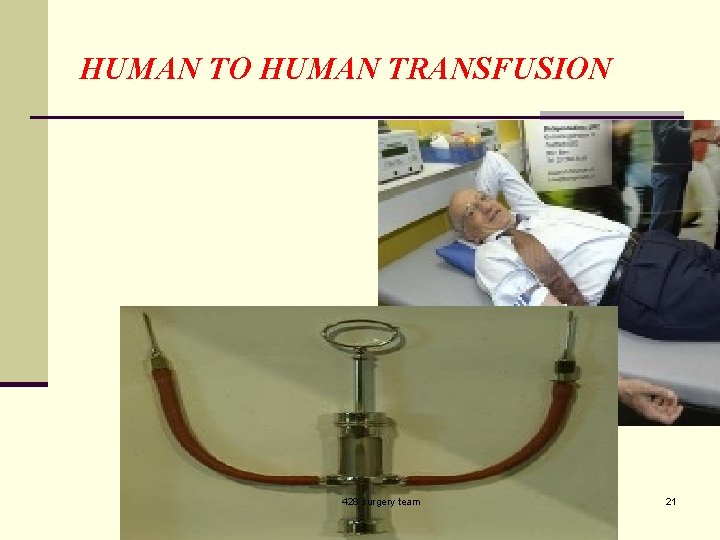 HUMAN TO HUMAN TRANSFUSION 428 surgery team 21 