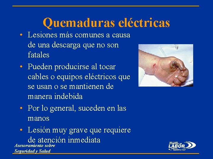 Quemaduras eléctricas • Lesiones más comunes a causa de una descarga que no son