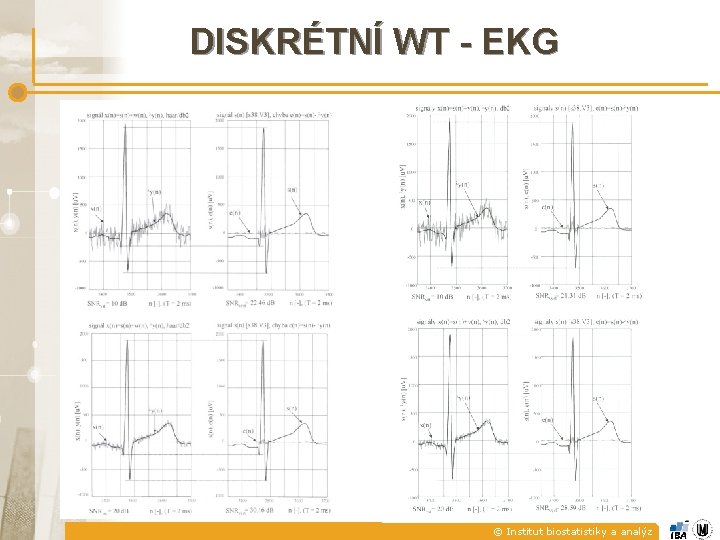 DISKRÉTNÍ WT - EKG © Institut biostatistiky a analýz 