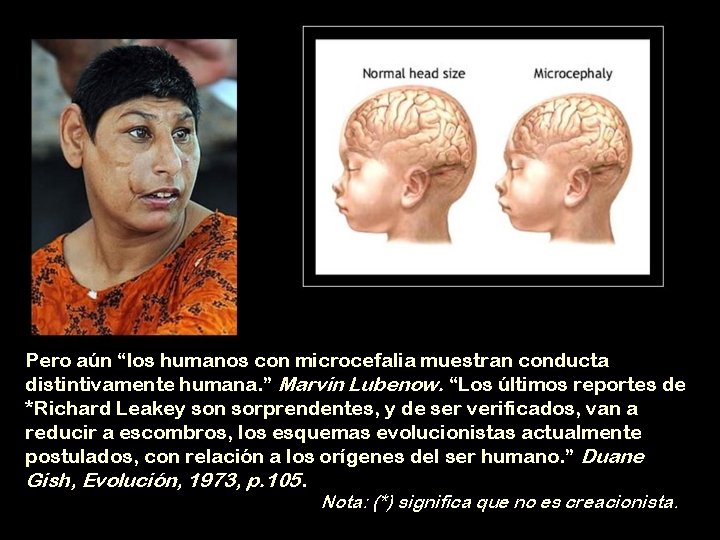 Pero aún “los humanos con microcefalia muestran conducta distintivamente humana. ” Marvin Lubenow. “Los