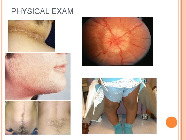 PHYSICAL EXAM 