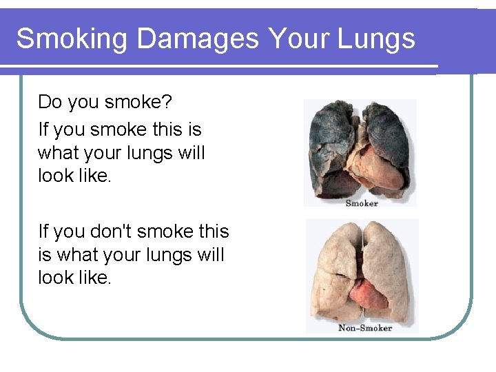 Smoking Damages Your Lungs Do you smoke? If you smoke this is what your