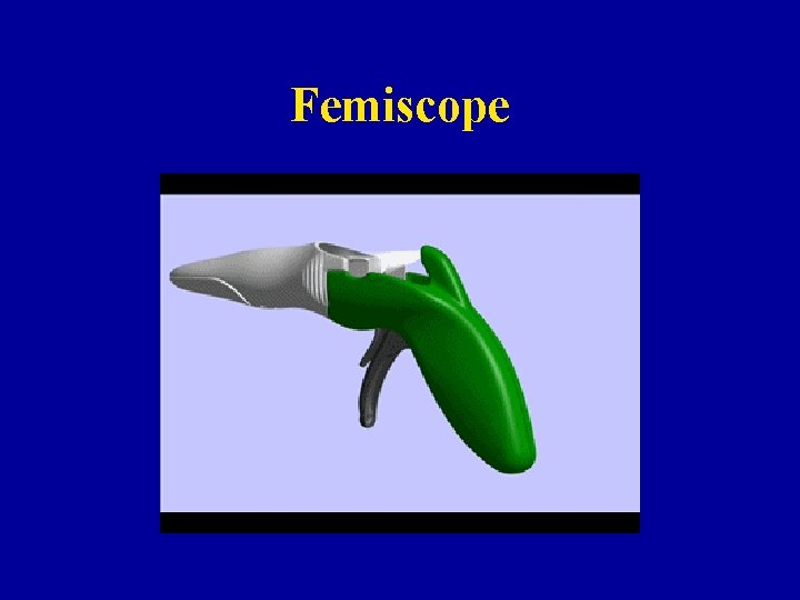 Femiscope 