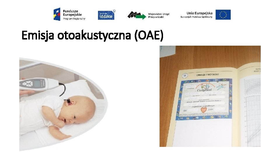 Emisja otoakustyczna (OAE) 