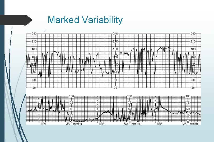 Marked Variability Marked Variability