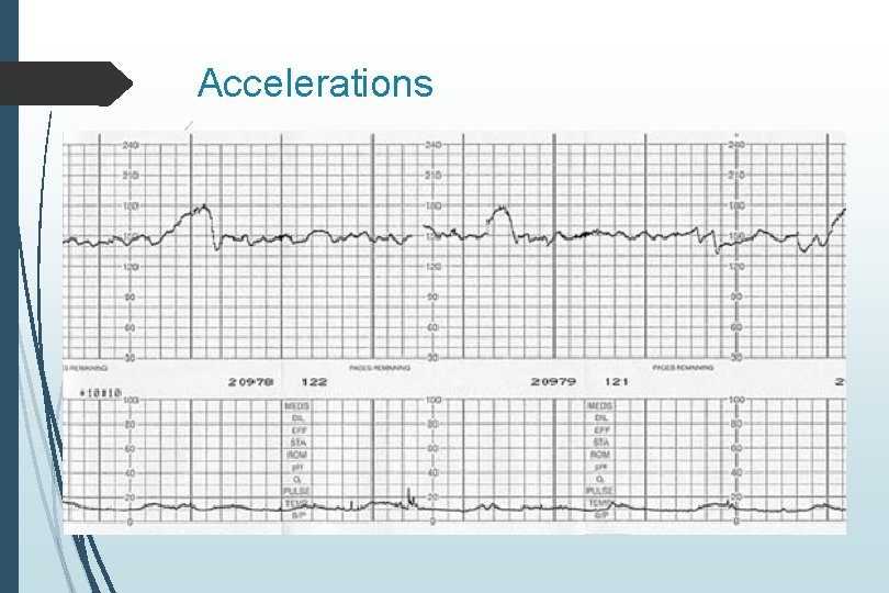 Accelerations Accelerations