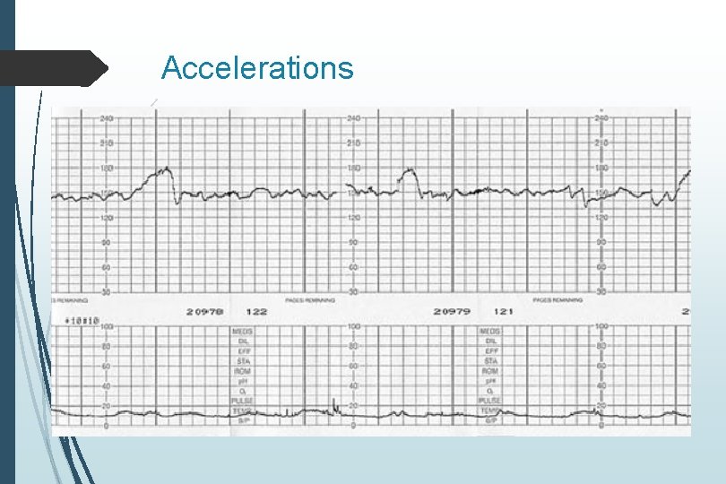 Accelerations 