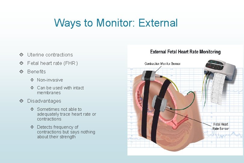 Ways to Monitor: External Uterine contractions Fetal heart rate (FHR) Benefits Non-invasive Can be