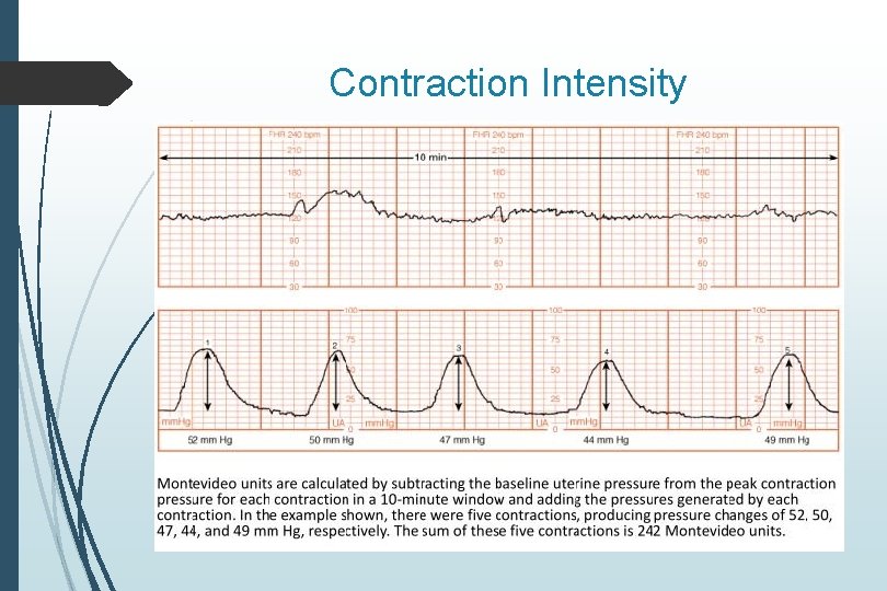 Contraction Intensity Contraction Intensity
