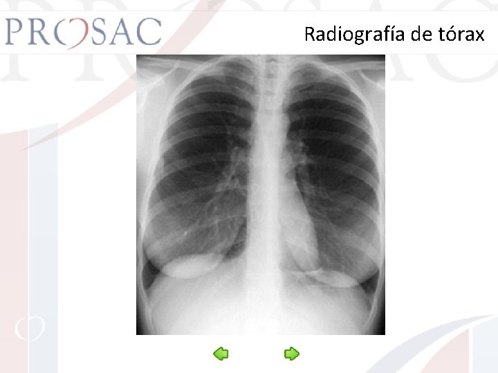  Radiografía de tórax 