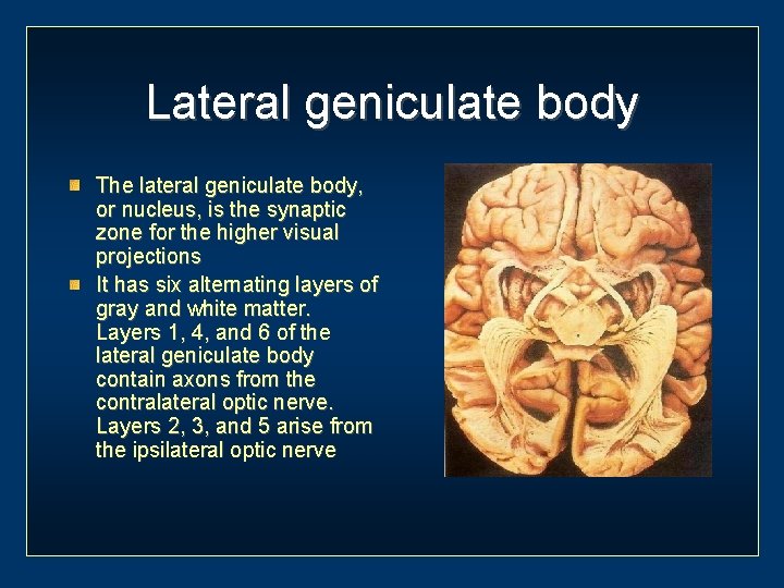 Lateral geniculate body The lateral geniculate body, or nucleus, is the synaptic zone for