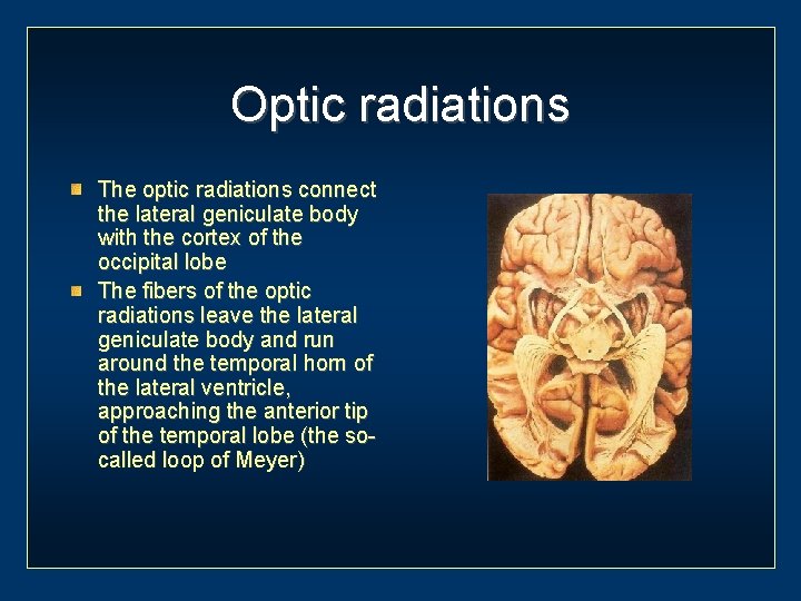 Optic radiations The optic radiations connect the lateral geniculate body with the cortex of