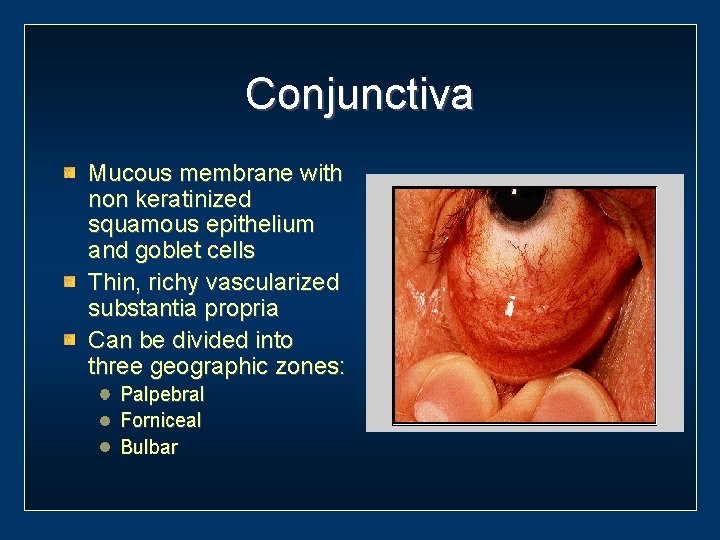Conjunctiva Mucous membrane with non keratinized squamous epithelium and goblet cells Thin, richy vascularized