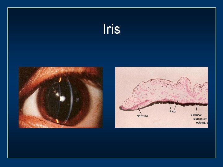 Iris 