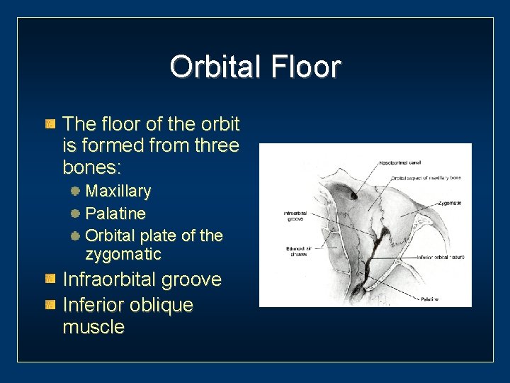 Orbital Floor The floor of the orbit is formed from three bones: Maxillary Palatine