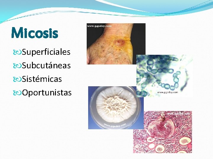 Micosis Superficiales Subcutáneas Sistémicas Oportunistas 