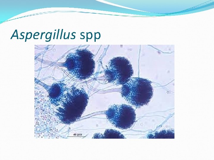 Aspergillus spp 