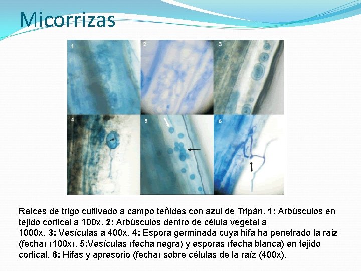 Micorrizas Raíces de trigo cultivado a campo teñidas con azul de Tripán. 1: Arbúsculos