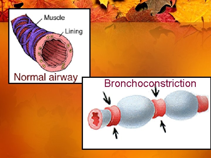 Bronchoconstriction 