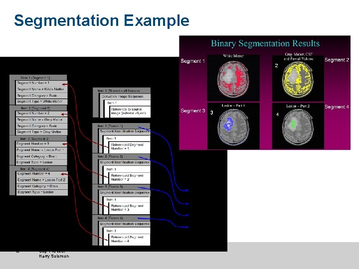 Segmentation Example 46 Sup 145 WSI Harry Solomon 