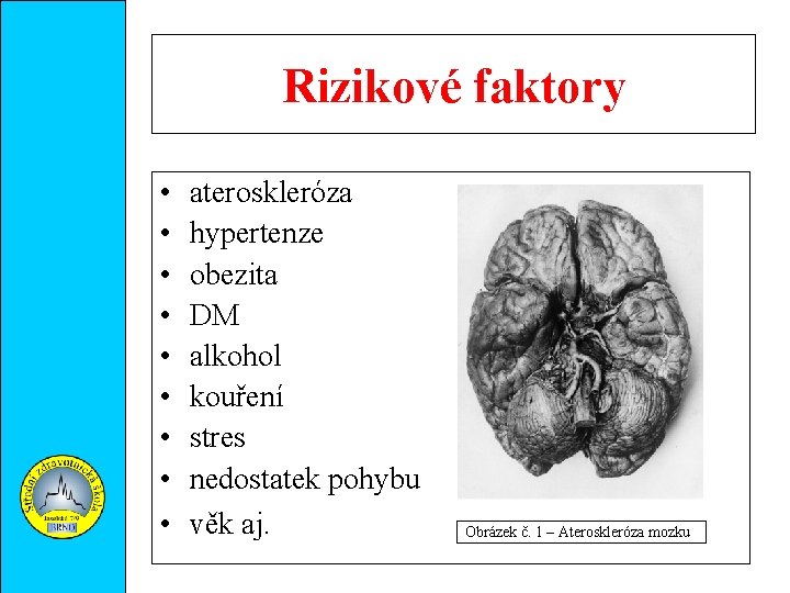 Rizikové faktory • • • ateroskleróza hypertenze obezita DM alkohol kouření stres nedostatek pohybu