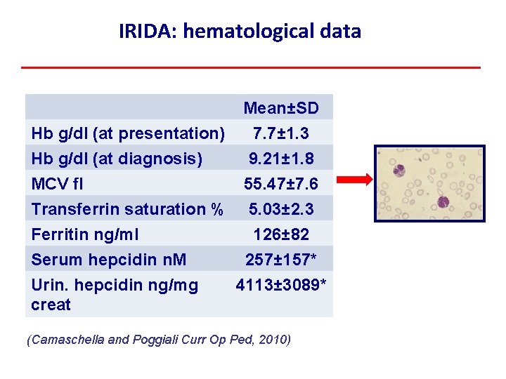 IRIDA: hematological data Mean±SD Hb g/dl (at presentation) 7. 7± 1. 3 Hb g/dl