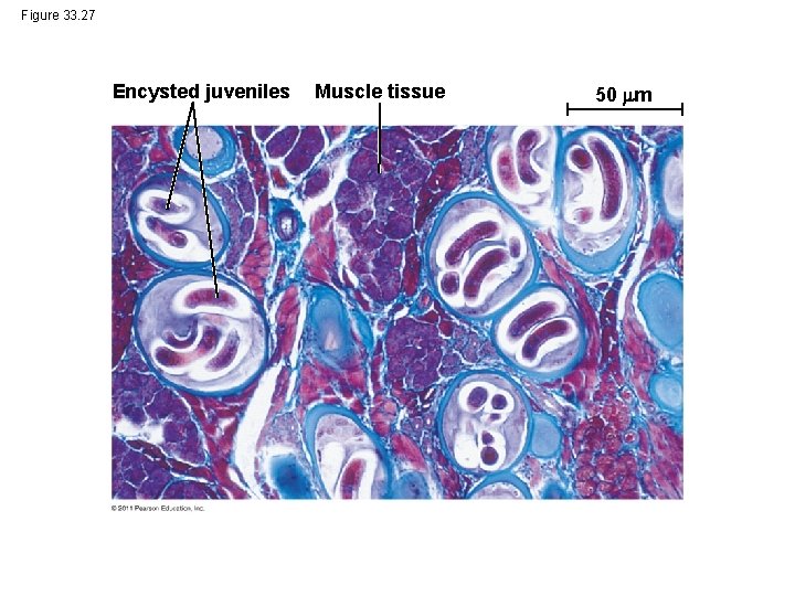 Figure 33. 27 Encysted juveniles Muscle tissue 50 m 