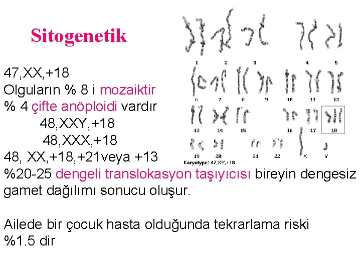 Sitogenetik 47, XX, +18 Olguların % 8 i mozaiktir % 4 çifte anöploidi vardır