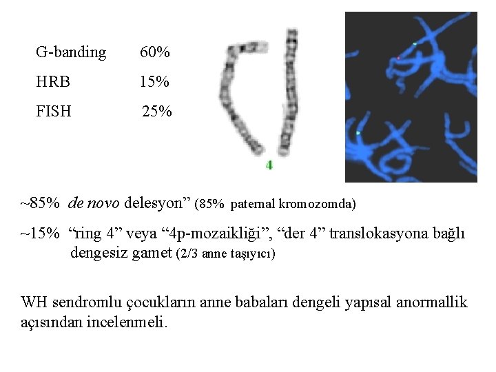 G-banding 60% HRB 15% FISH 25% ~85% de novo delesyon” (85% paternal kromozomda) ~15%