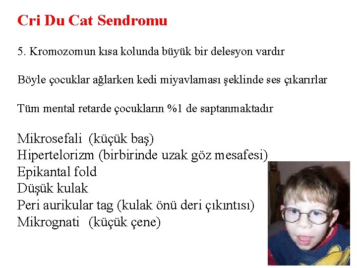 Cri Du Cat Sendromu 5. Kromozomun kısa kolunda büyük bir delesyon vardır Böyle çocuklar