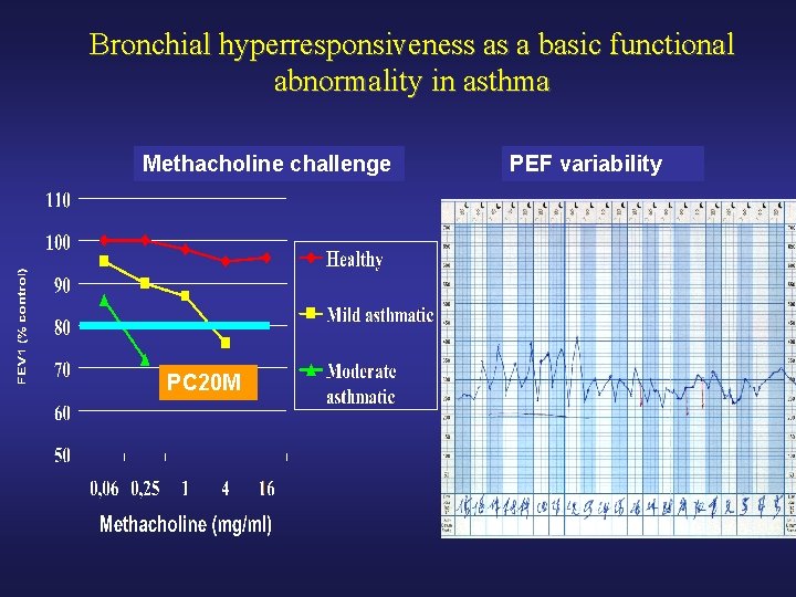 Bronchial hyperresponsiveness as a basic functional abnormality in asthma Methacholine challenge PC 20 M