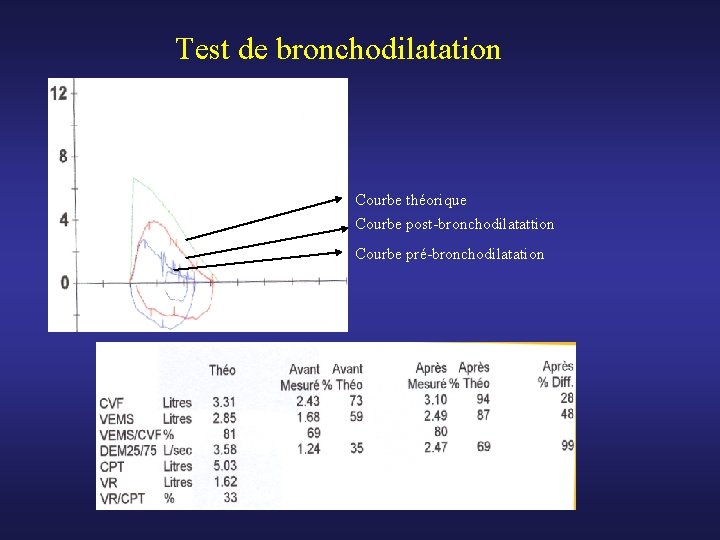 Test de bronchodilatation Courbe théorique Courbe post-bronchodilatattion Courbe pré-bronchodilatation 