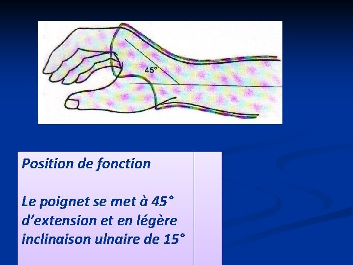 Position de fonction Le poignet se met à 45° d’extension et en légère inclinaison