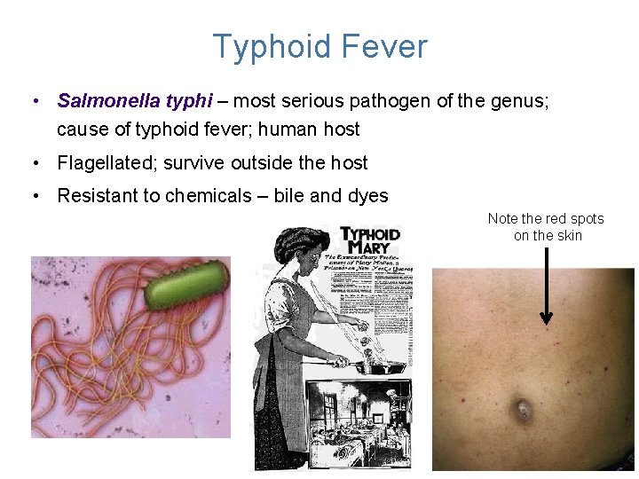 Typhoid Fever • Salmonella typhi – most serious pathogen of the genus; cause of