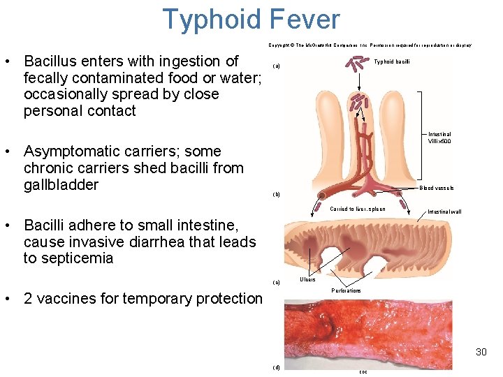 Typhoid Fever Copyright © The Mc. Graw-Hill Companies, Inc. Permission required for reproduction or