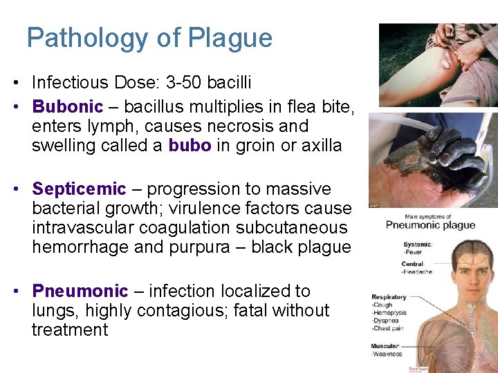 Pathology of Plague • Infectious Dose: 3 -50 bacilli • Bubonic – bacillus multiplies