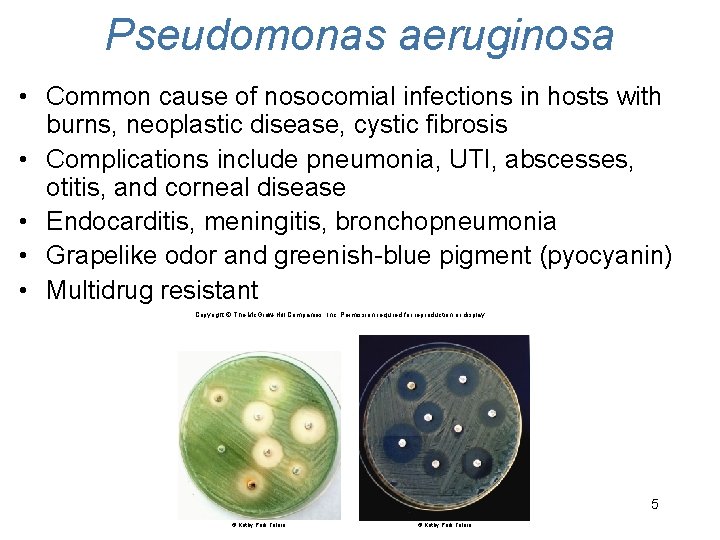 Pseudomonas aeruginosa • Common cause of nosocomial infections in hosts with burns, neoplastic disease,