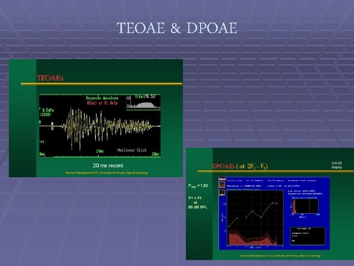 TEOAE & DPOAE 