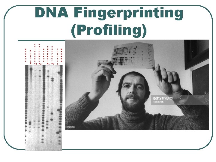 DNA Fingerprinting (Profiling) 