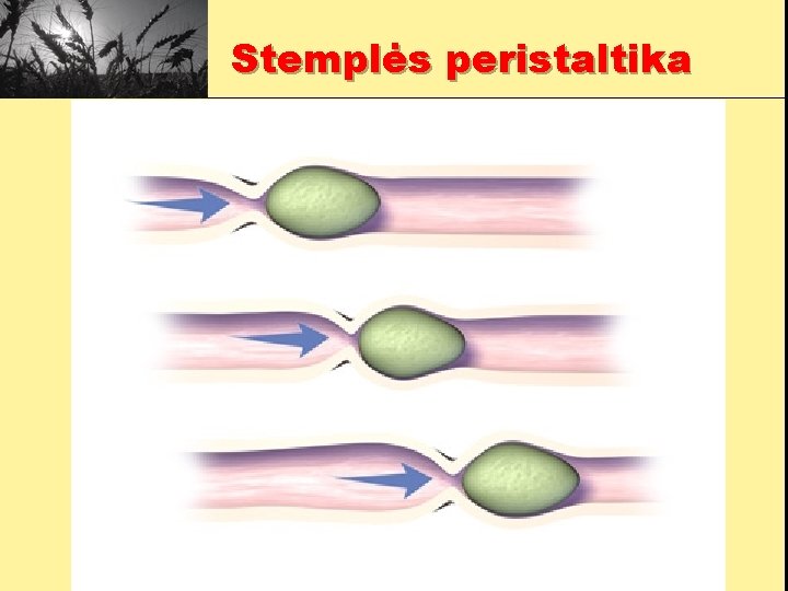 Stemplės peristaltika 