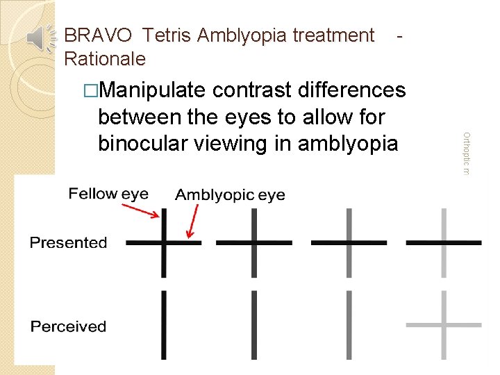 BRAVO Tetris Amblyopia treatment - Rationale �Manipulate contrast differences Orthoptic meeting July 2013 between